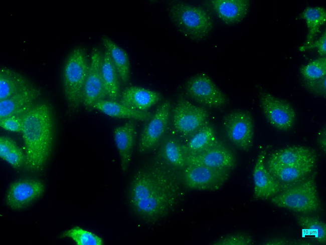 ZFYVE9 Antibody in Immunocytochemistry (ICC/IF)