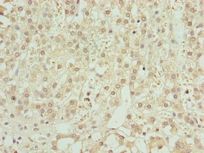 ZNF821 Antibody in Immunohistochemistry (Paraffin) (IHC (P))