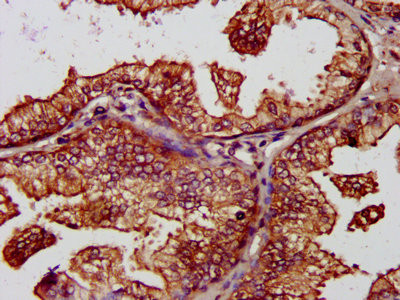 BAP31 Antibody in Immunohistochemistry (Paraffin) (IHC (P))