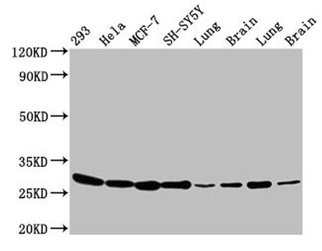 BAP31 Antibody in Western Blot (WB)