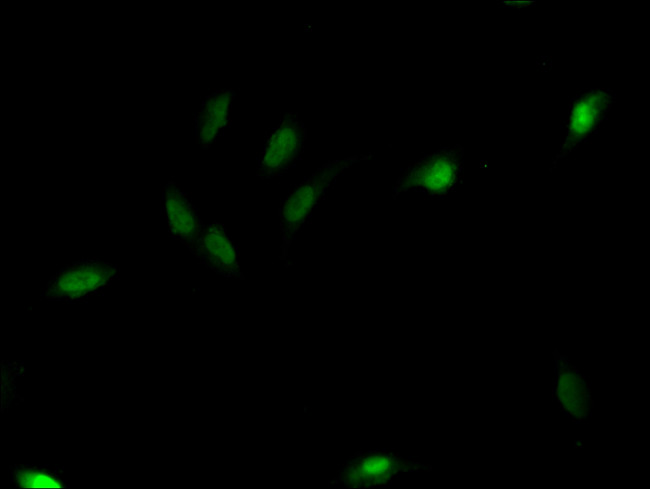 C1D Antibody in Immunocytochemistry (ICC/IF)