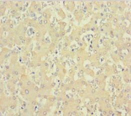 C1D Antibody in Immunohistochemistry (Paraffin) (IHC (P))