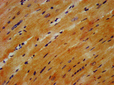 GABARAPL2 Antibody in Immunohistochemistry (Paraffin) (IHC (P))