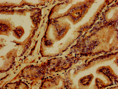 GABARAPL2 Antibody in Immunohistochemistry (Paraffin) (IHC (P))