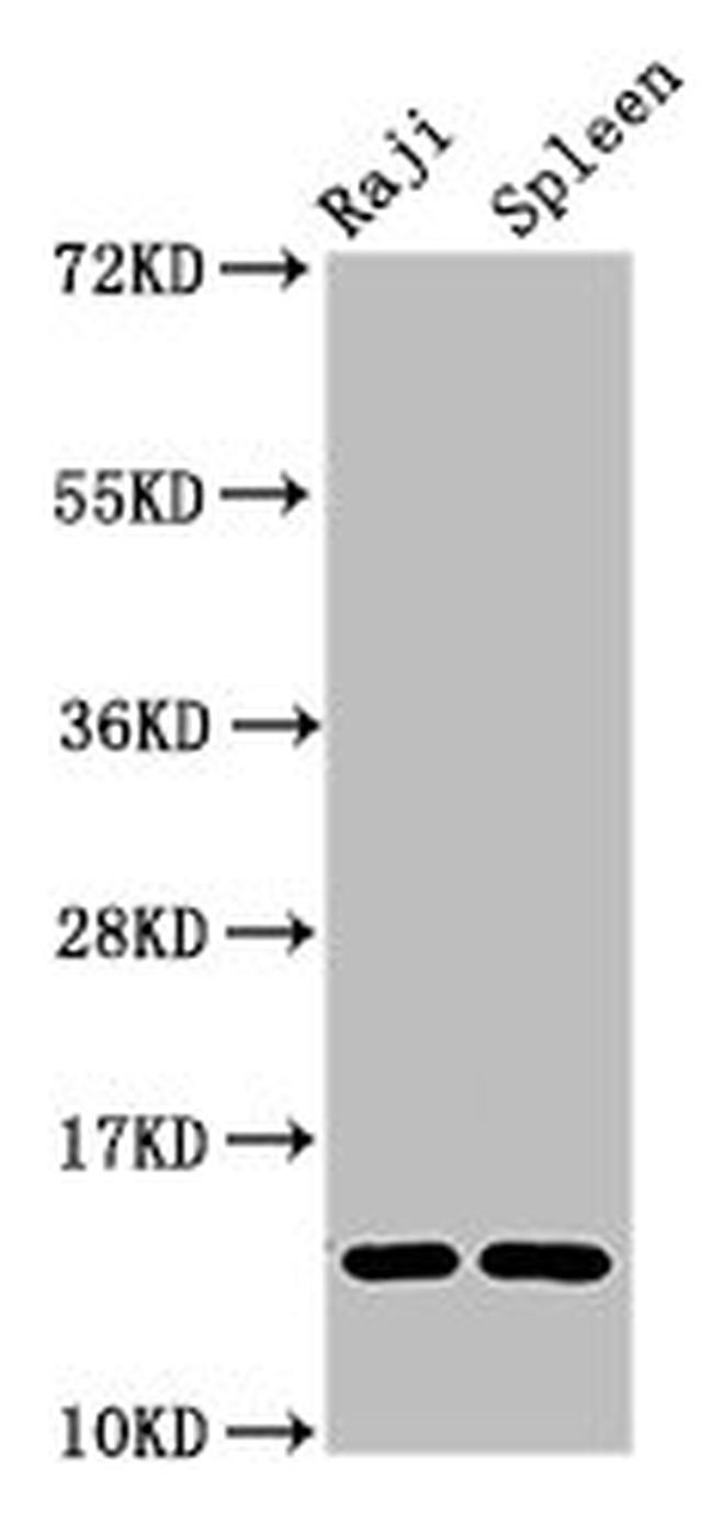 GABARAPL2 Antibody in Western Blot (WB)