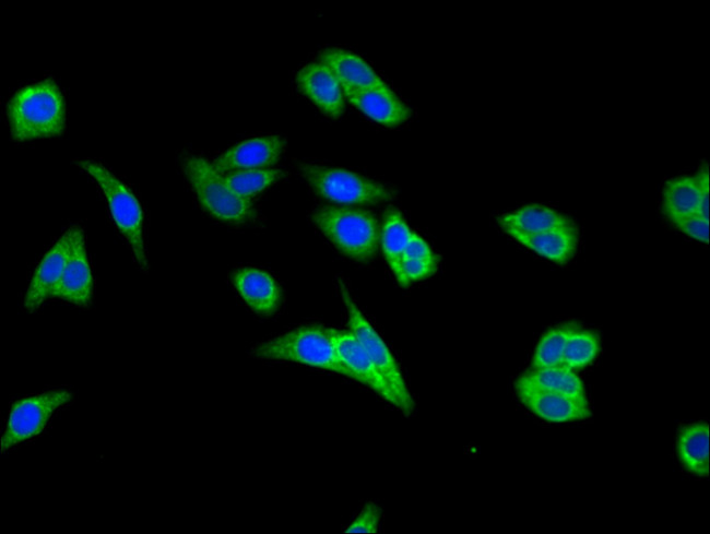 MEK2 Antibody in Immunocytochemistry (ICC/IF)