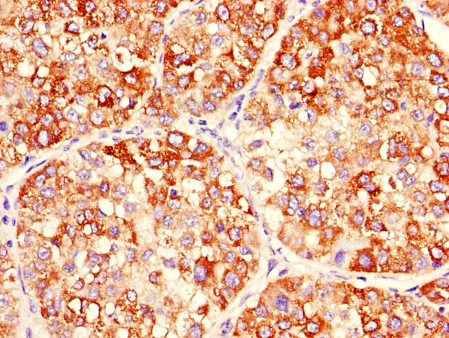 MEK2 Antibody in Immunohistochemistry (Paraffin) (IHC (P))