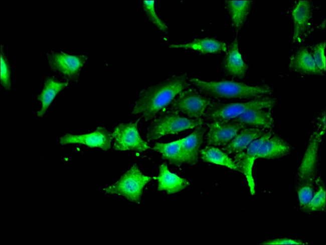 GSK3 alpha Antibody in Immunocytochemistry (ICC/IF)