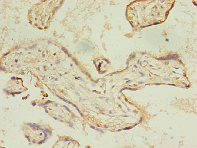 ACSL4 Antibody in Immunohistochemistry (Paraffin) (IHC (P))