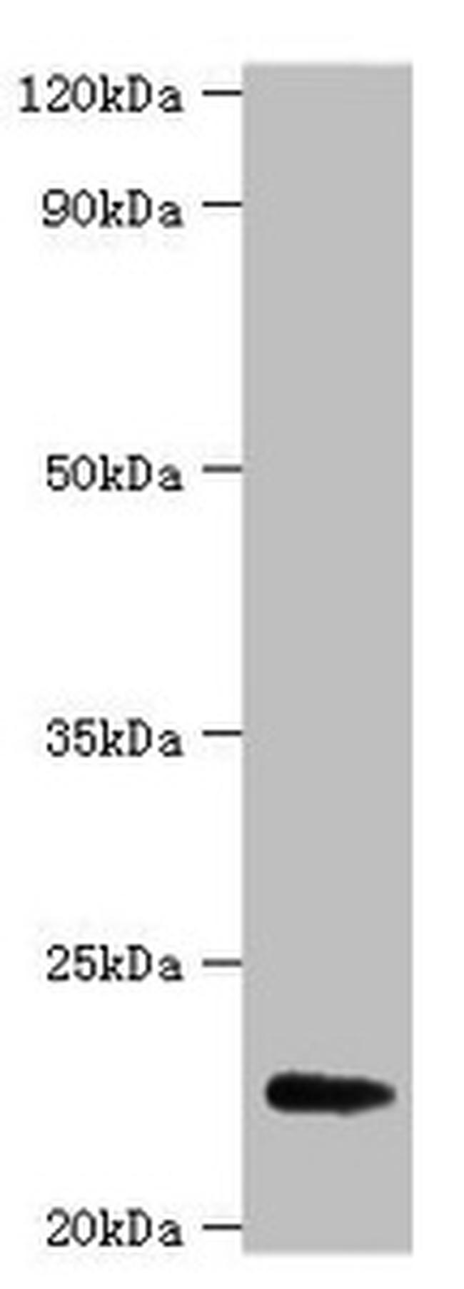 FGF21 Antibody in Western Blot (WB)