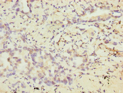 VEGFC Antibody in Immunohistochemistry (Paraffin) (IHC (P))