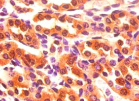 FABP3 Antibody in Immunohistochemistry (Paraffin) (IHC (P))