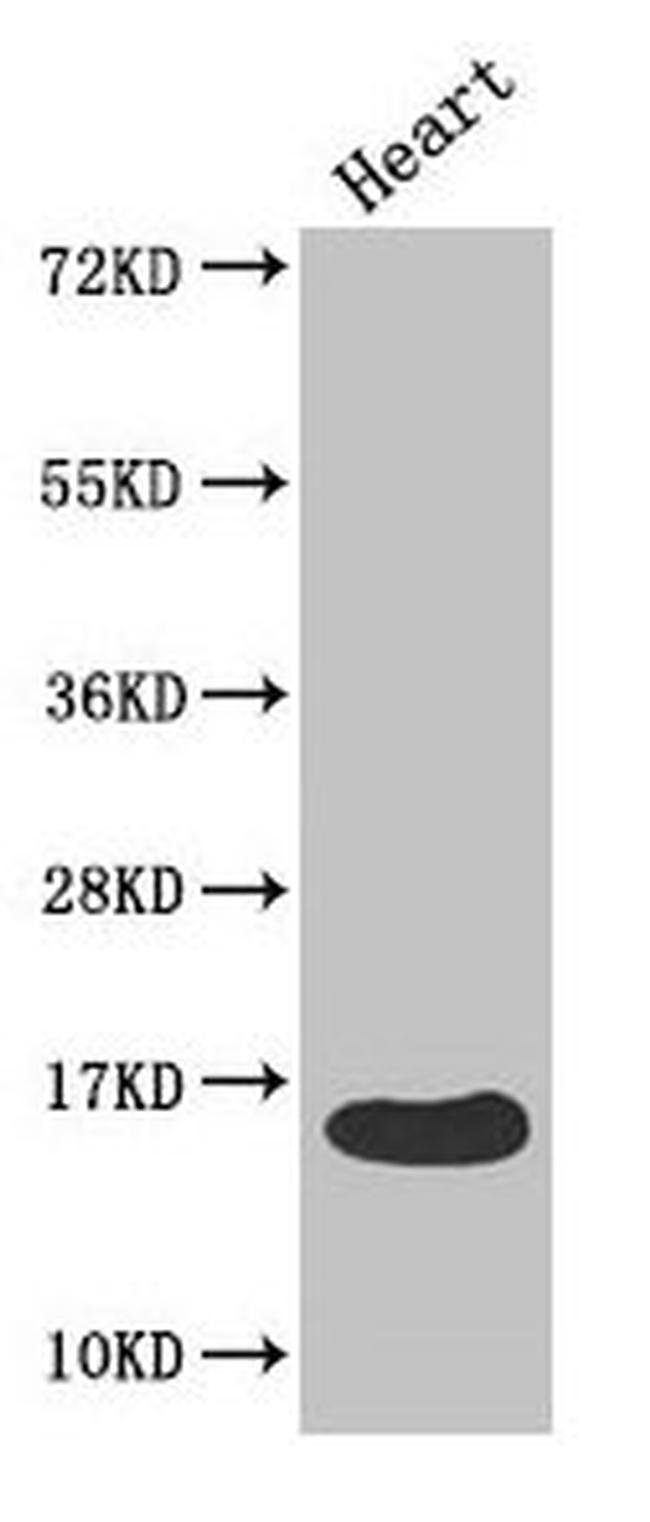 FABP3 Antibody in Western Blot (WB)