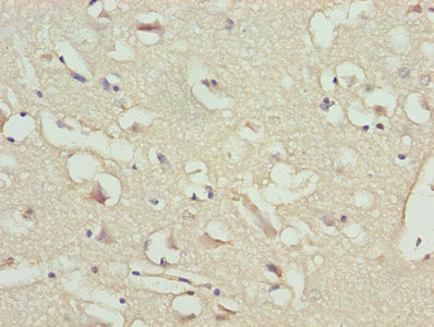 BNP Antibody in Immunohistochemistry (Paraffin) (IHC (P))