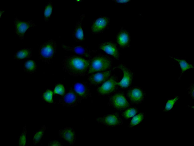 CD137 (4-1BB) Antibody in Immunocytochemistry (ICC/IF)