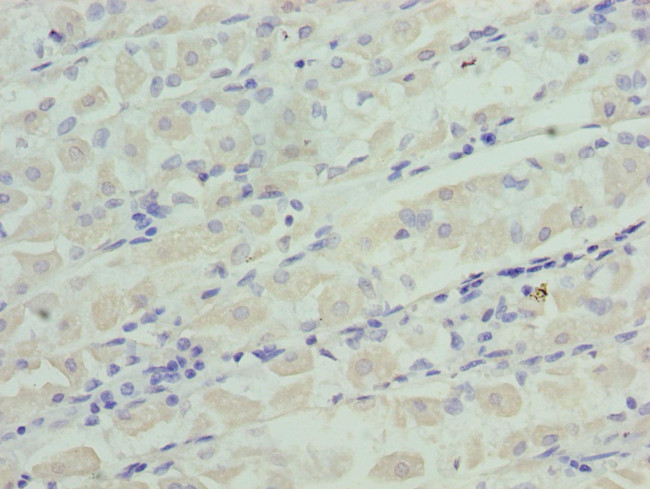 IGFBP-1 Antibody in Immunohistochemistry (Paraffin) (IHC (P))