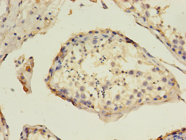 TIM-1 Antibody in Immunohistochemistry (Paraffin) (IHC (P))