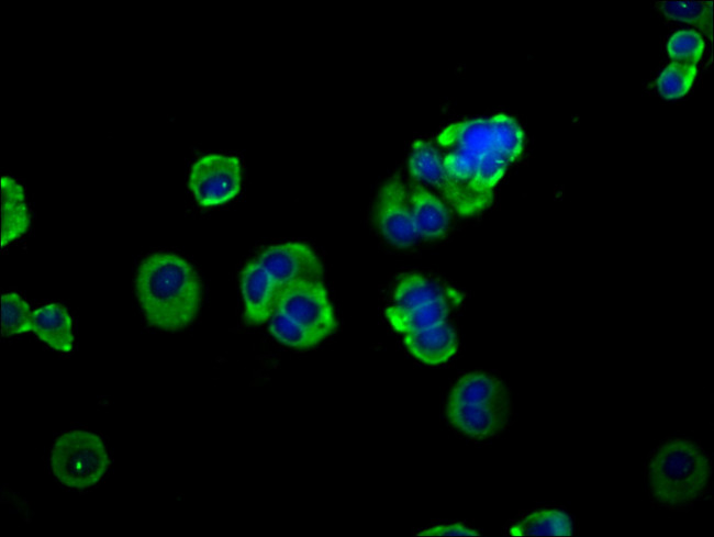 ADAM8 Antibody in Immunocytochemistry (ICC/IF)