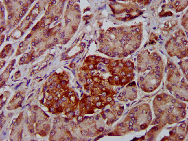 ADAM8 Antibody in Immunohistochemistry (Paraffin) (IHC (P))