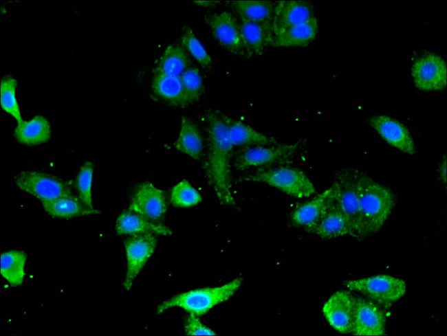 CD3z Antibody in Immunocytochemistry (ICC/IF)