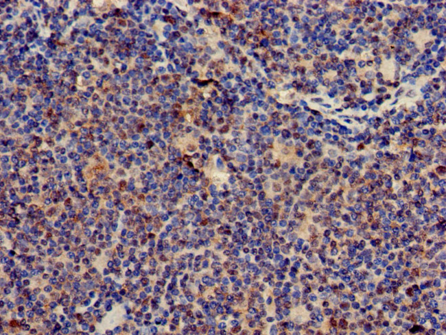 CD3z Antibody in Immunohistochemistry (Paraffin) (IHC (P))