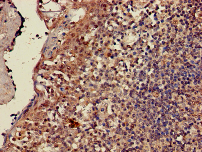 CD3z Antibody in Immunohistochemistry (Paraffin) (IHC (P))