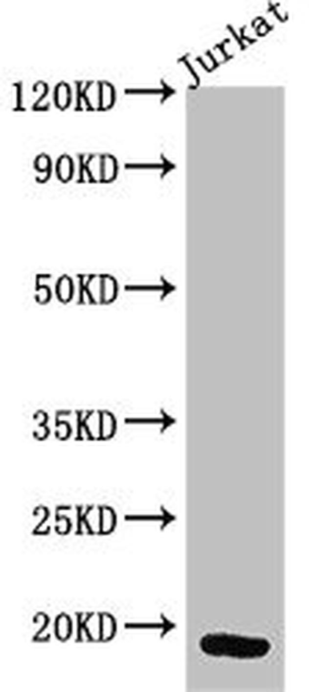 CD3z Antibody in Western Blot (WB)