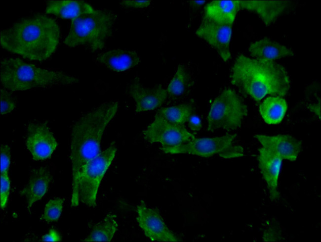 PAI1 Antibody in Immunocytochemistry (ICC/IF)