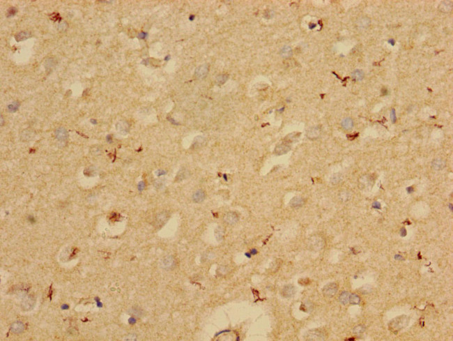 PAI1 Antibody in Immunohistochemistry (Paraffin) (IHC (P))