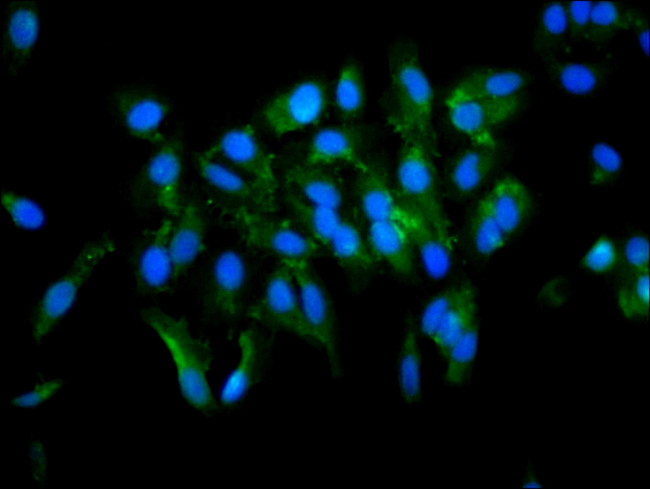 TGM2 Antibody in Immunocytochemistry (ICC/IF)