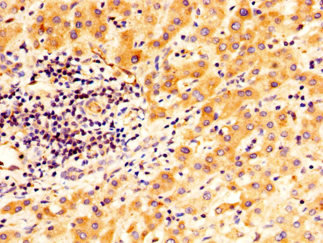 TGM2 Antibody in Immunohistochemistry (Paraffin) (IHC (P))