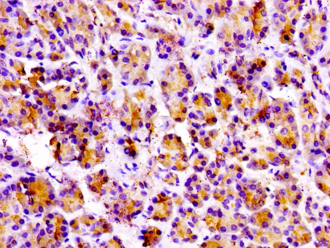 PRSS3 Antibody in Immunohistochemistry (Paraffin) (IHC (P))