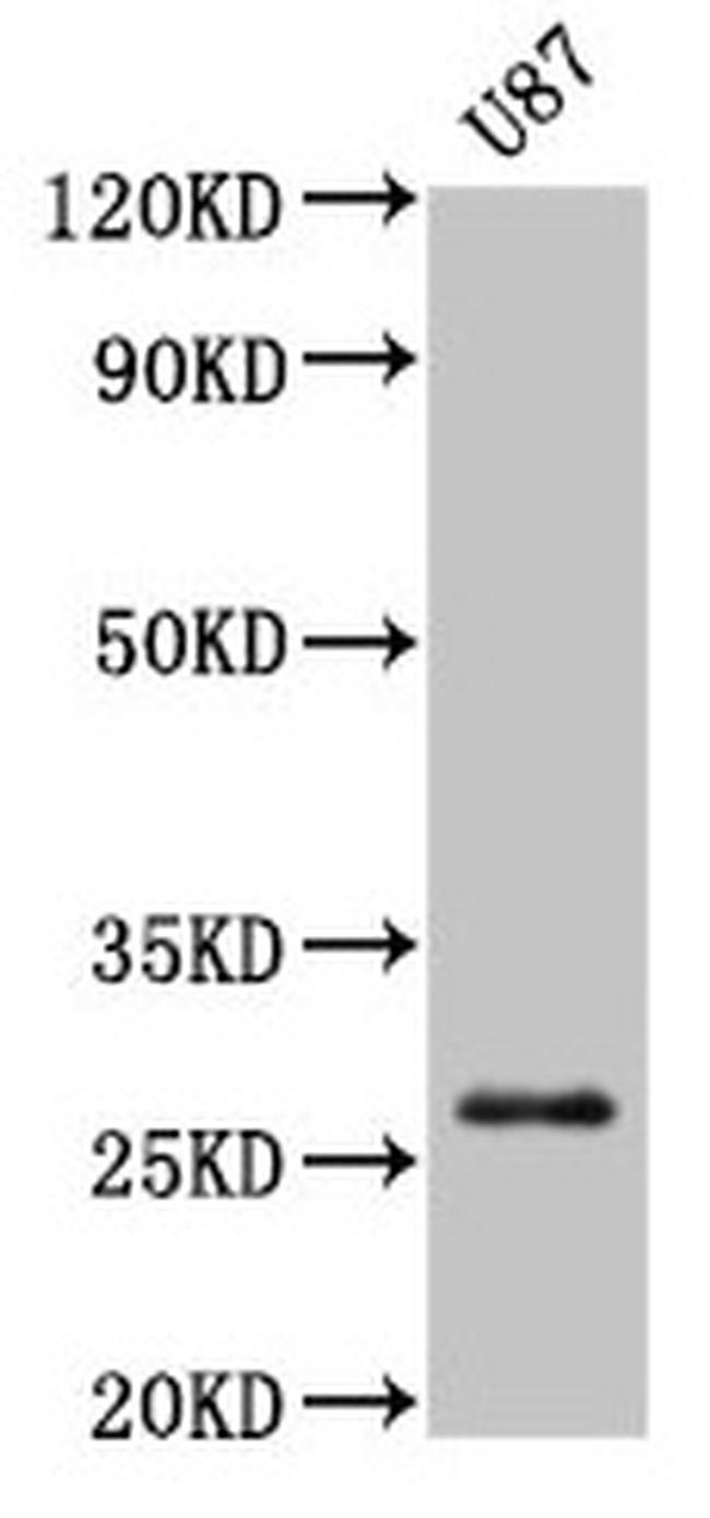 PRSS3 Antibody in Western Blot (WB)