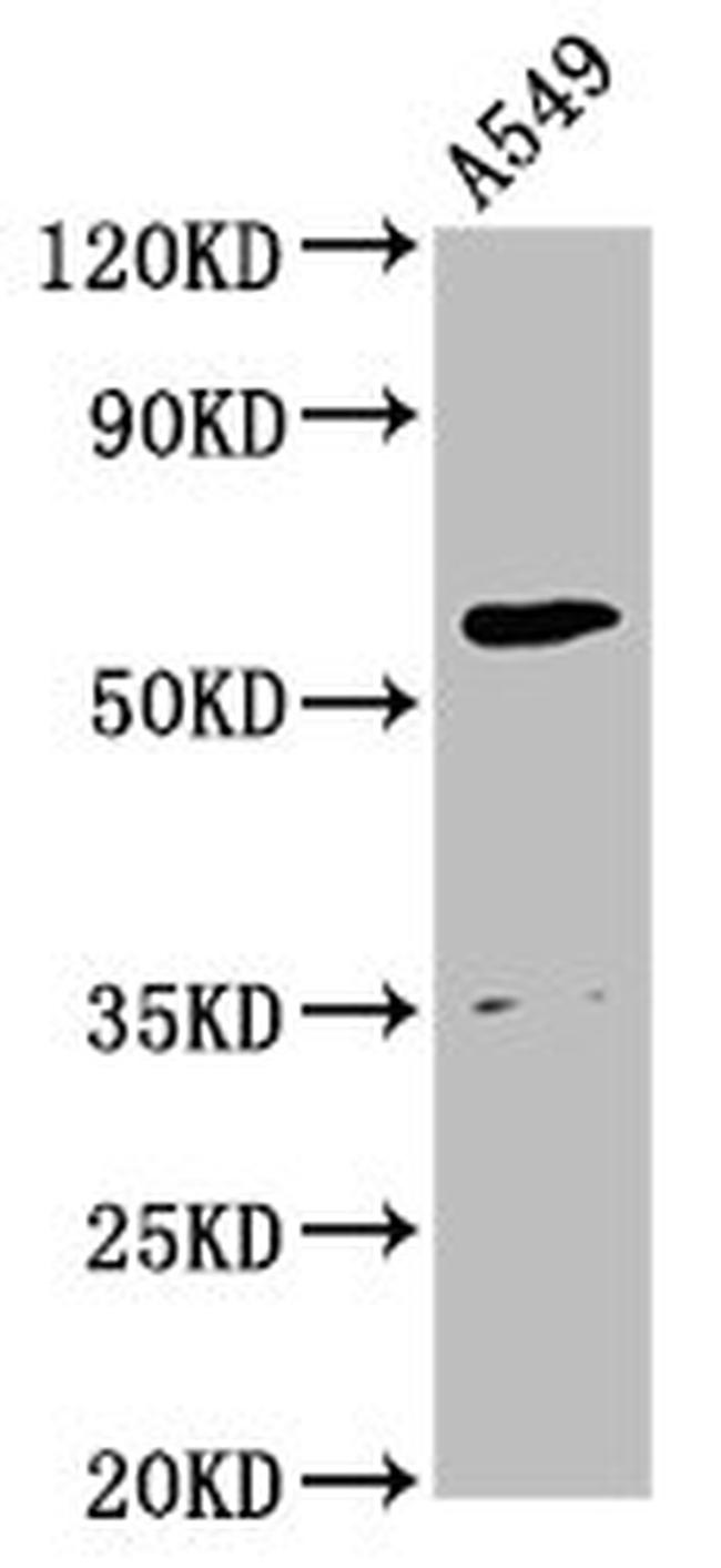 AMH Antibody in Western Blot (WB)