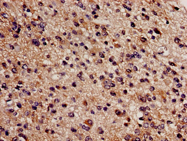 CBS Antibody in Immunohistochemistry (Paraffin) (IHC (P))