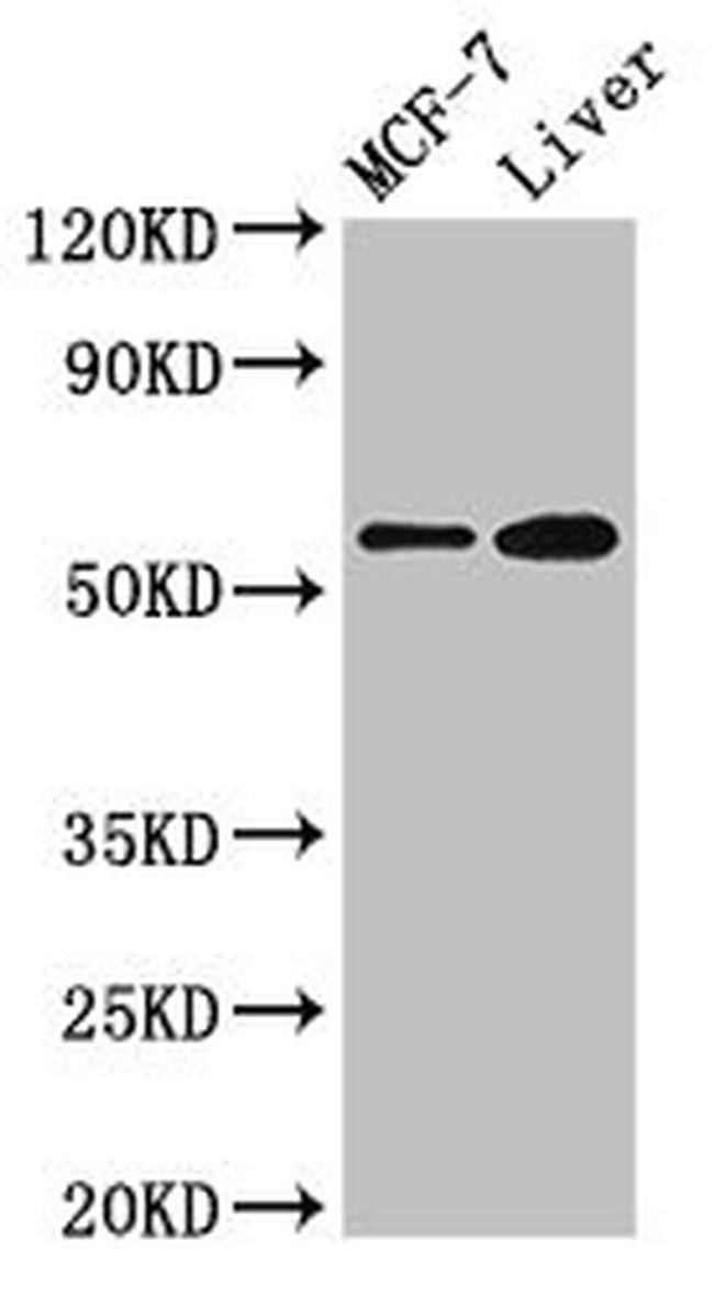 CBS Antibody in Western Blot (WB)