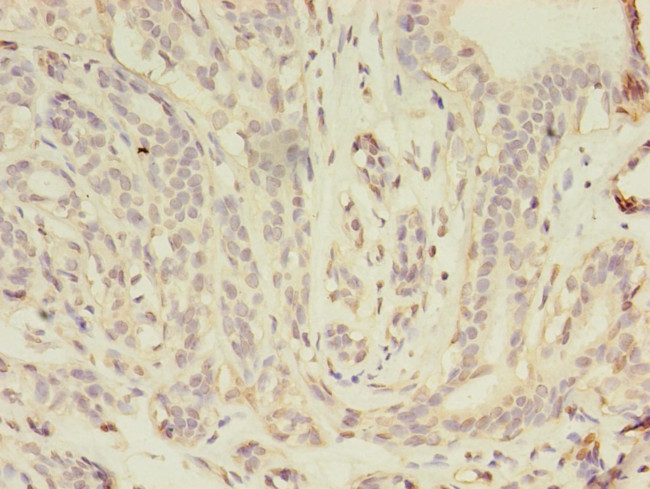 gamma Catenin Antibody in Immunohistochemistry (Paraffin) (IHC (P))