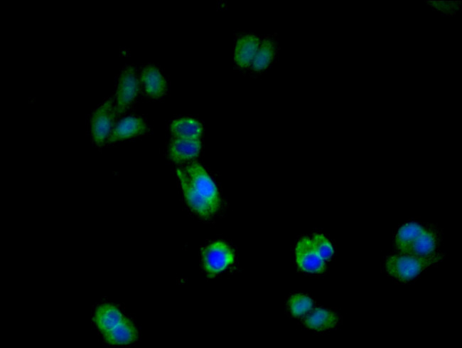 IL17RA Antibody in Immunocytochemistry (ICC/IF)