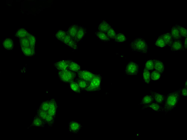 INHBB Antibody in Immunocytochemistry (ICC/IF)