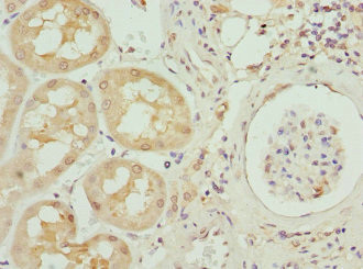 INHBB Antibody in Immunohistochemistry (Paraffin) (IHC (P))