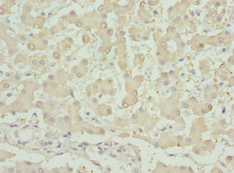 INHBB Antibody in Immunohistochemistry (Paraffin) (IHC (P))