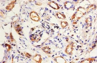 Kininogen Light Chain Antibody in Immunohistochemistry (Paraffin) (IHC (P))