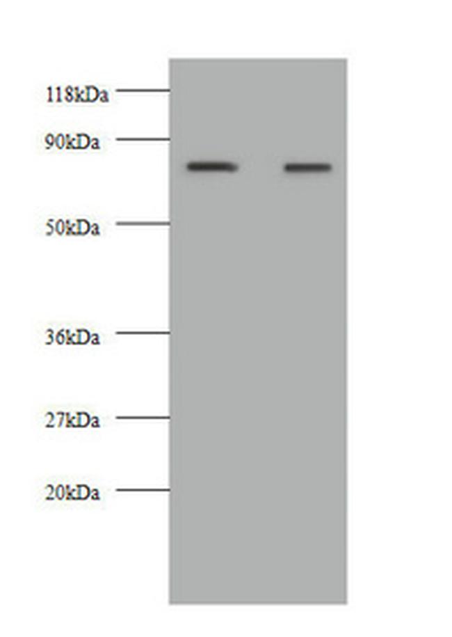 Kininogen Light Chain Antibody in Western Blot (WB)