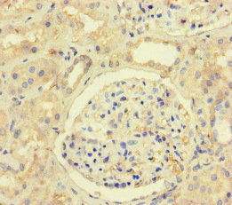 MLH1 Antibody in Immunohistochemistry (Paraffin) (IHC (P))