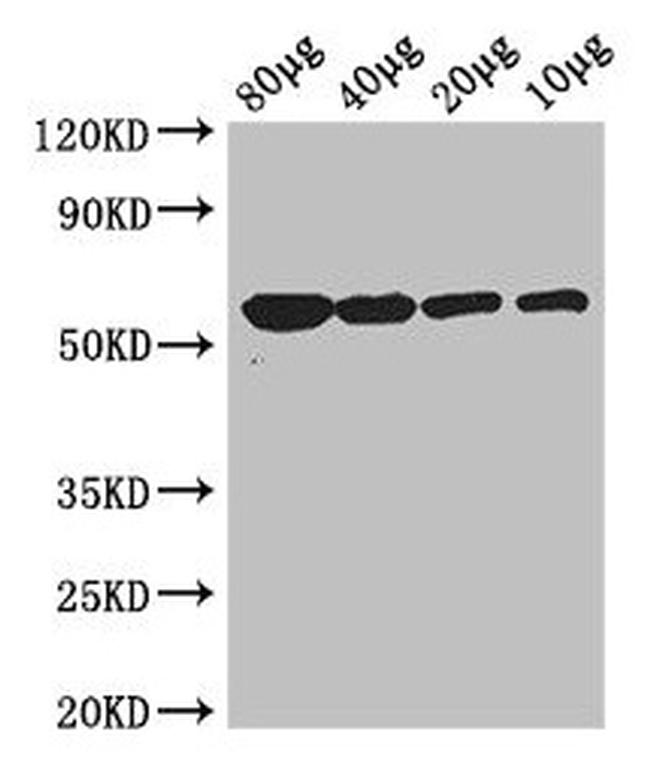 Glycerol kinase Antibody in Western Blot (WB)