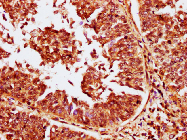 CABIN1 Antibody in Immunohistochemistry (Paraffin) (IHC (P))