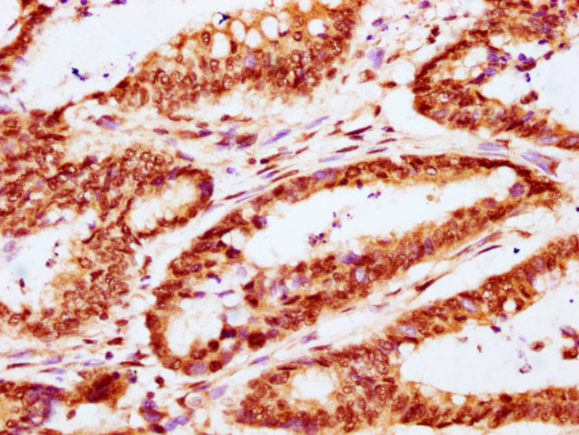 CABIN1 Antibody in Immunohistochemistry (Paraffin) (IHC (P))