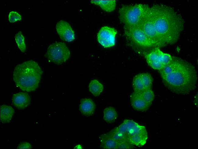 PDE1B Antibody in Immunocytochemistry (ICC/IF)