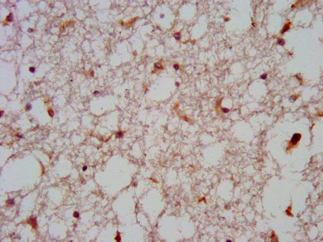 GNAS Antibody in Immunohistochemistry (Paraffin) (IHC (P))