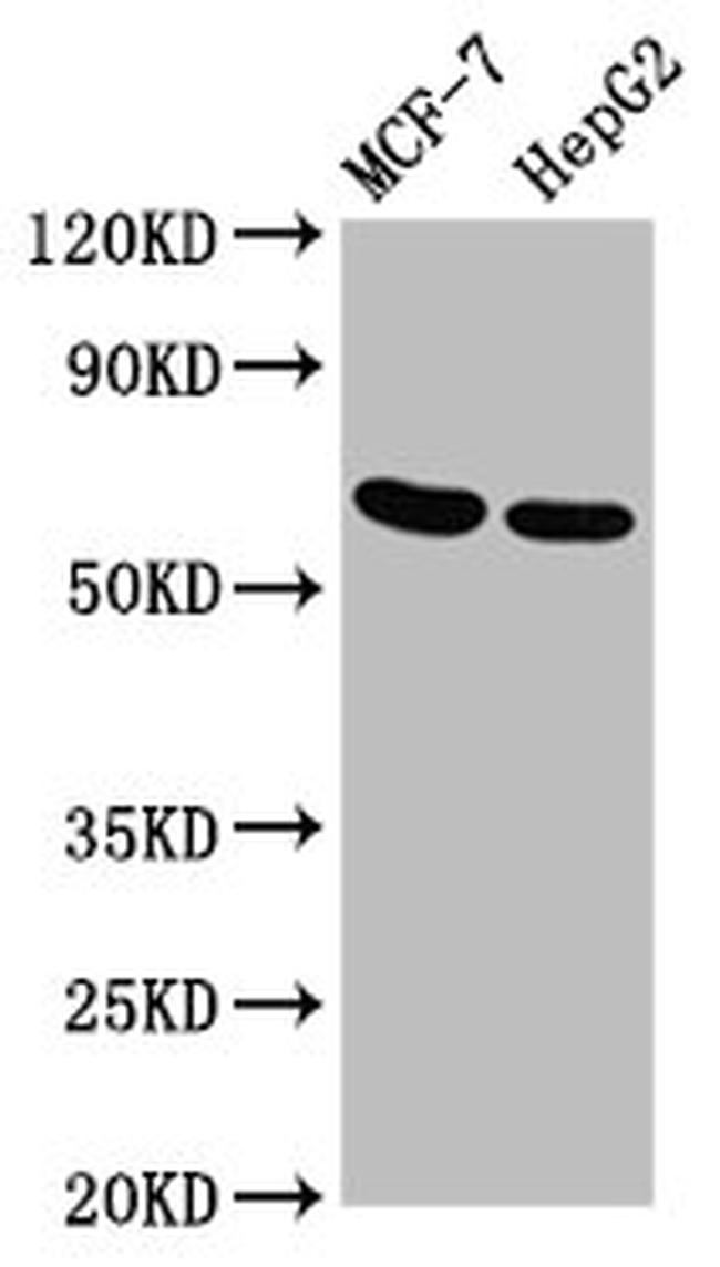 GNAS Antibody in Western Blot (WB)